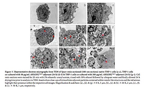 AANs-inside-MF.jpg