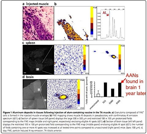 Al-adjuvant-detected-in-brain1.jpg