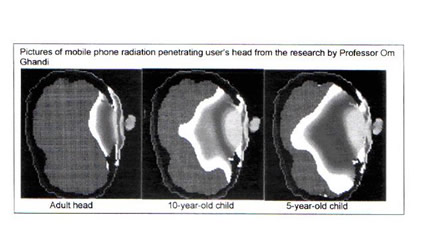Cellulare Tumore Cancro Cervello Cellulari Telefoni Mobili Cancro Tumori Cervello Dispositivi  Mobili Onde 5